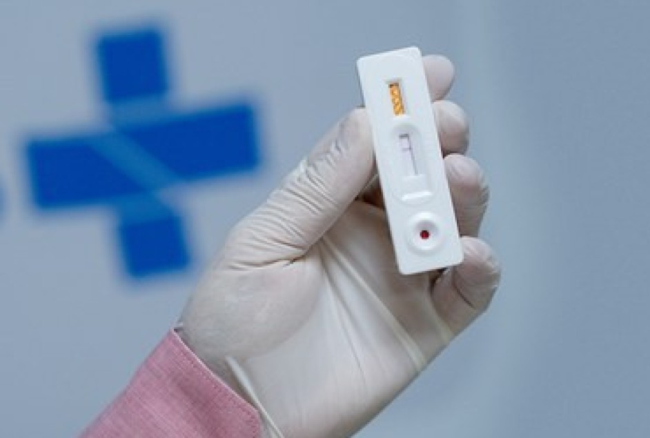 Setor de Vigilância em Saúde oferece testes rápidos em empresas associadas à Apeme